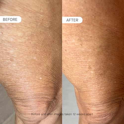 Age Reversal Body Moisturizing Cream