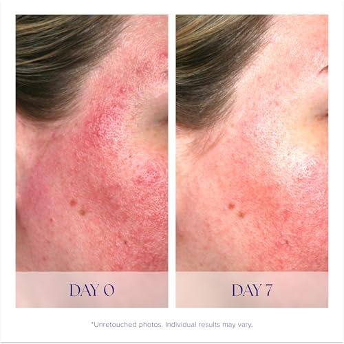 Antioxidant Vitamin C Face Serum