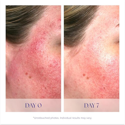 Antioxidant Vitamin C Face Serum