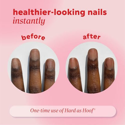 Hardening Nail Strengthening Treatment