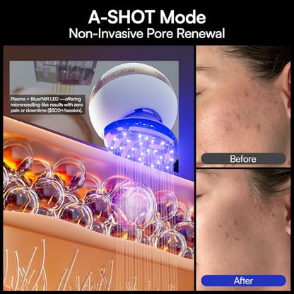 8-in-1 Microcurrent Facial Device