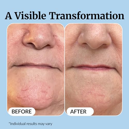 Vibriance Super C Vitamin C Serum for Mature Skin