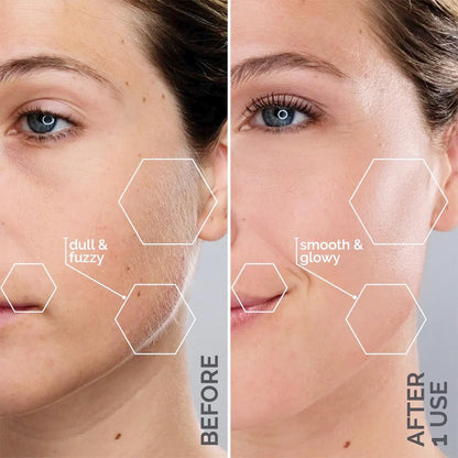 Sonic Dermaplaning Facial Exfoliation Tool