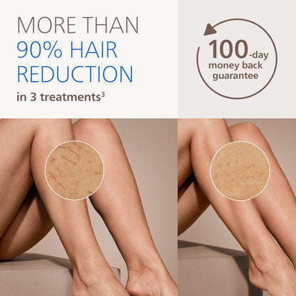IPL Hair Removal Device with SenseIQ Technology