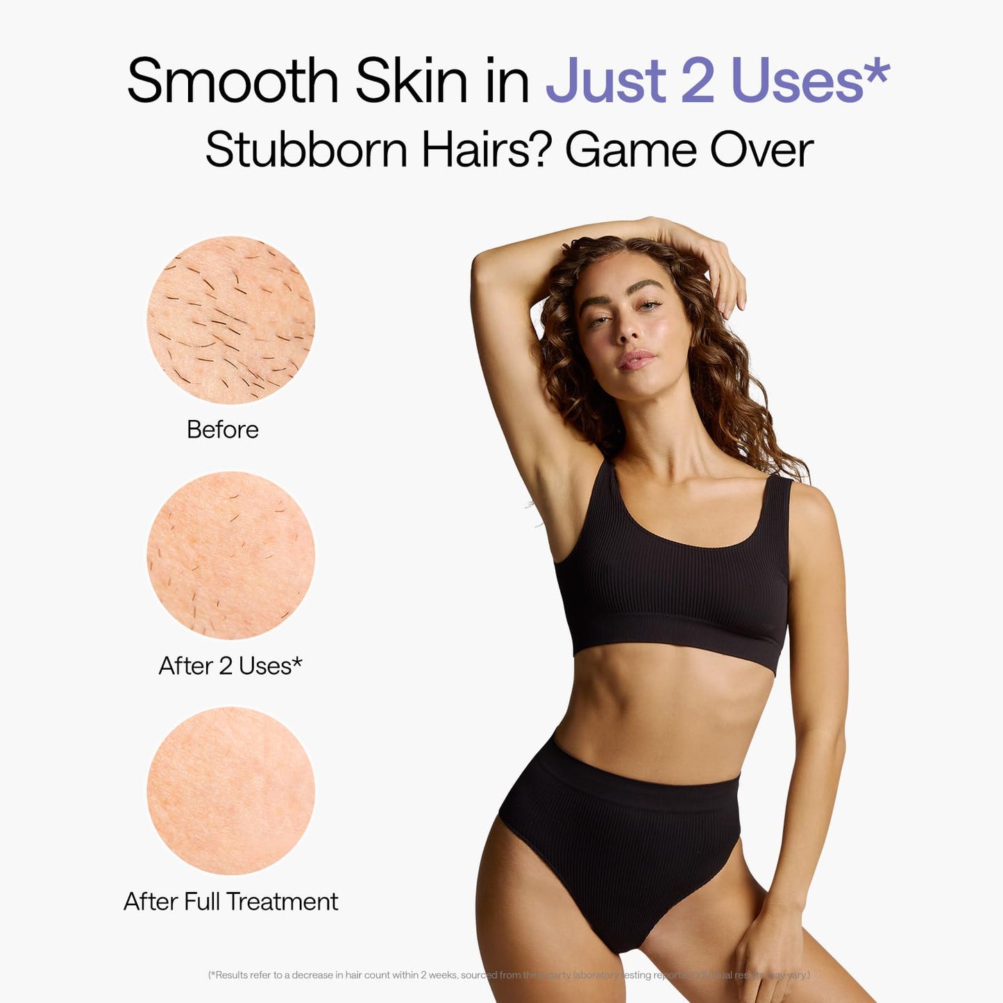 Air 10 IPL Hair Removal Device