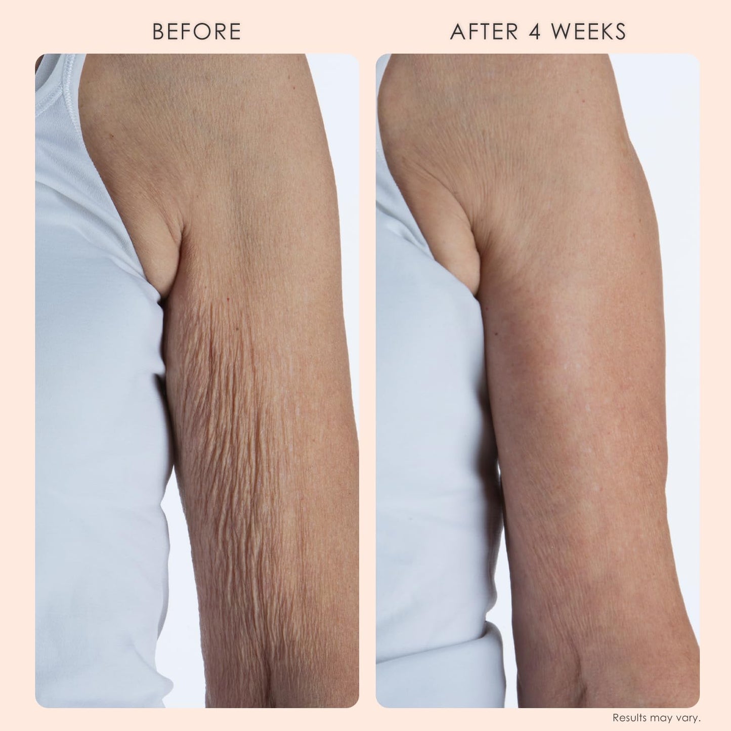 Crepe Repair Anti-Aging Body Cream