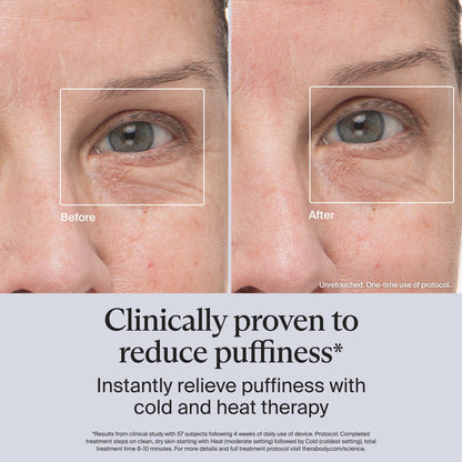 Depuffing Cold Heat Facial Beauty Wand