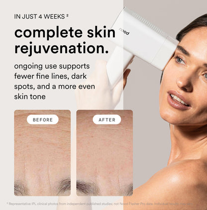 Flasher Pro IPL Hair Removal Device
