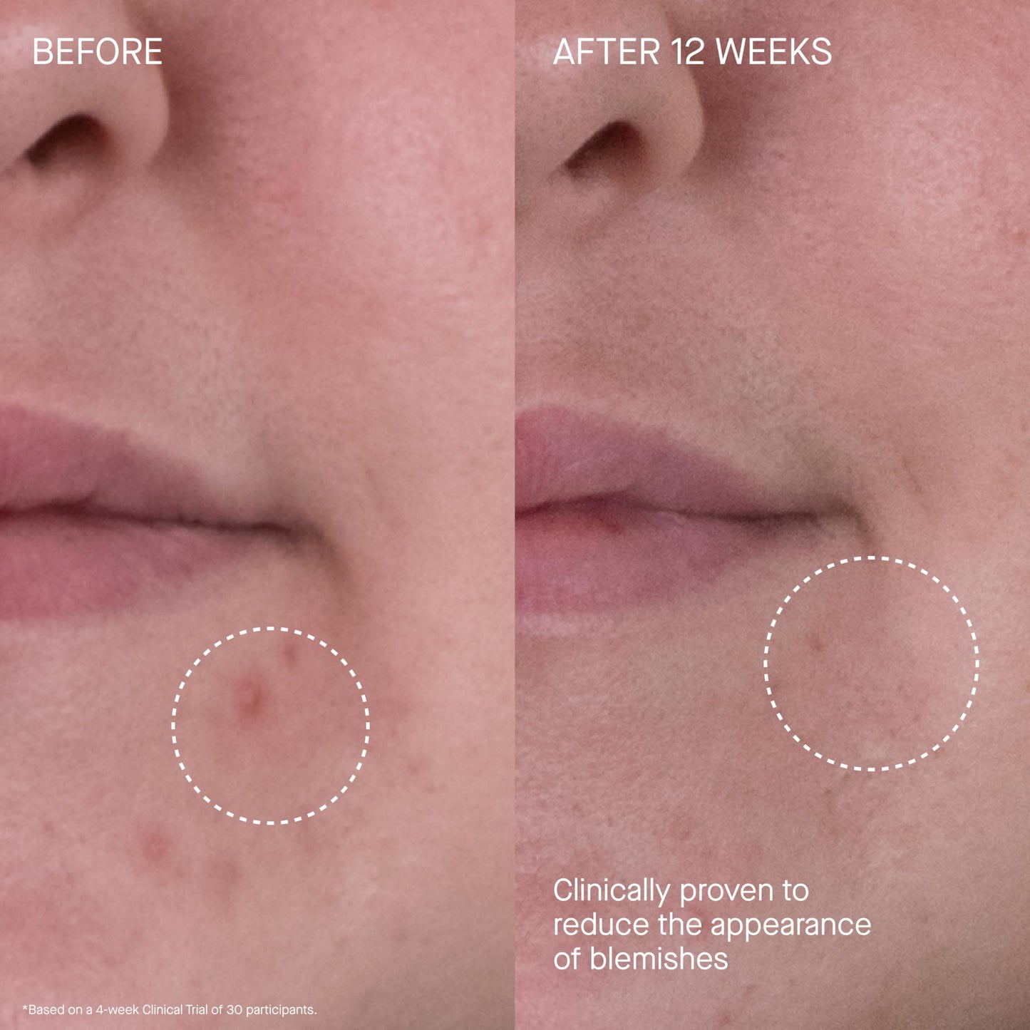 The Rich Hydrating Face Moisturizer