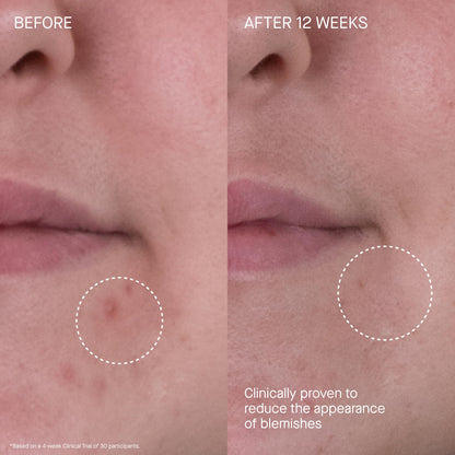 The Rich Hydrating Face Moisturizer